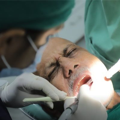 Root canal